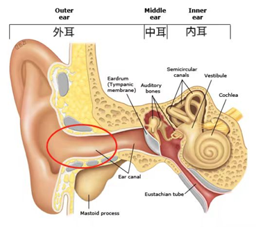 耳朵總是癢 卻啥也掏不出來(lái)！可能暗示這5種問(wèn)題