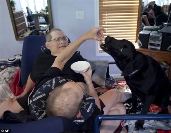 腹部相連只能輪流睡覺(jué)：世界長(zhǎng)壽男性連體雙胞胎 68歲同時(shí)去世