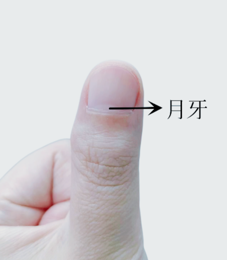 指甲出現(xiàn)一條黑線 別不當(dāng)回事！可能是癌變