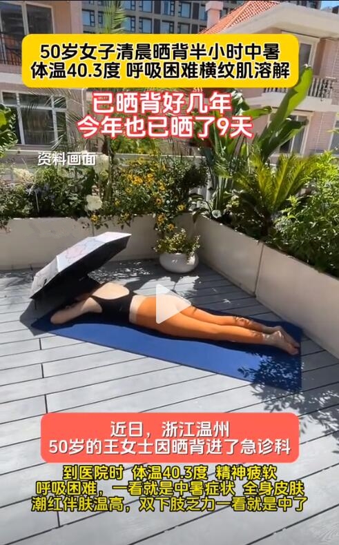 50歲女子曬背半小時(shí)中暑：精神疲軟呼吸困難