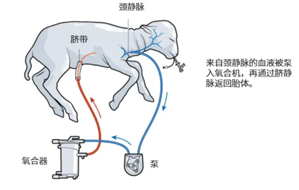 飆上熱搜的人造子宮 真的能讓男人也懷孕？