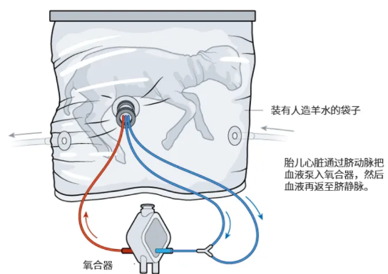 飆上熱搜的人造子宮 真的能讓男人也懷孕？