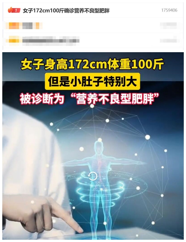 熱搜第一！女子172cm100斤確診營養(yǎng)不良型肥胖