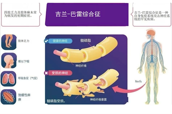 大學(xué)生因一頓燒烤進ICU 換了5次血：都怪它