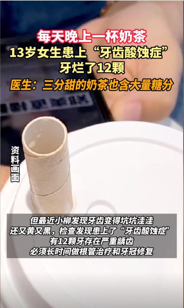 杭州13歲女生每天一杯奶茶牙被腐蝕：患有嚴(yán)重齲齒