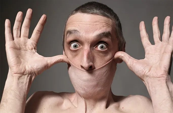 英國男子皮膚Q彈破紀錄：脖子皮膚一拉可當口罩戴