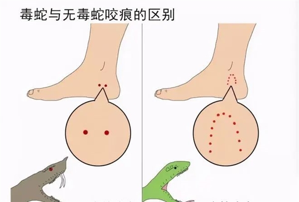 男子夜爬遭蛇咬倒地動(dòng)彈不得 緊急處理措施來(lái)了：一共6點(diǎn)