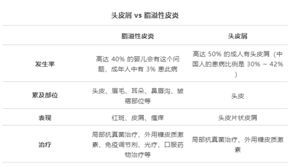 洗頭忽略了這一點(diǎn) 頭皮屑永遠(yuǎn)洗不干凈！