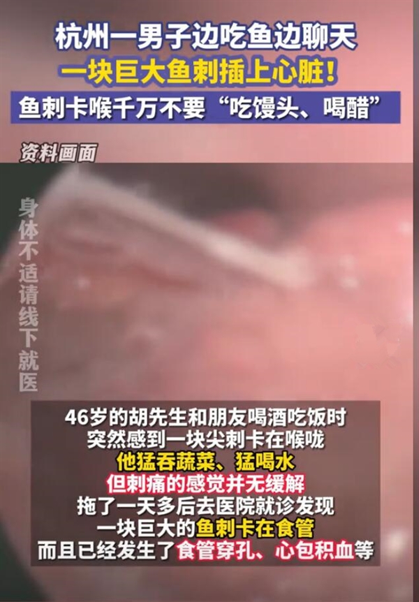喪命式自救后巨大魚刺直扎男子心臟 醫(yī)生：自救方法不可取