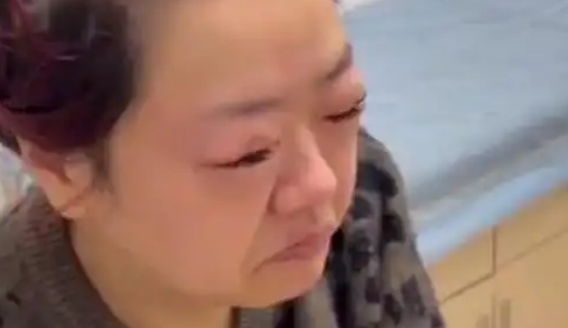 女子吃5斤車?yán)遄舆^敏腫成悲傷蛙 醫(yī)生提醒：過量食用所致