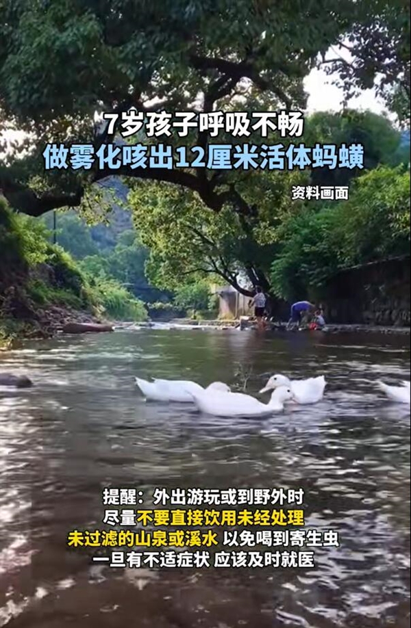 7歲孩子做霧化后咳出一條活體螞蝗：長約12厘米