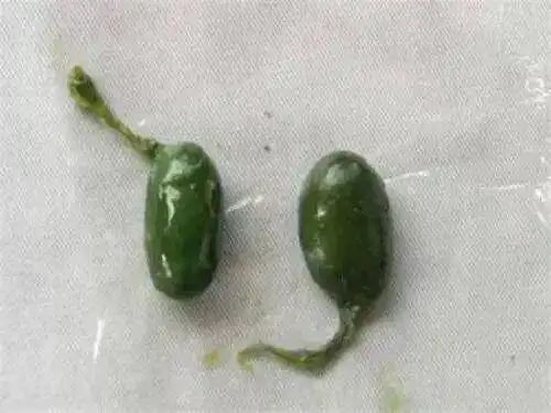 毒性勝過(guò)砒霜：2人輕信偏方生吞魚(yú)膽致器官衰竭